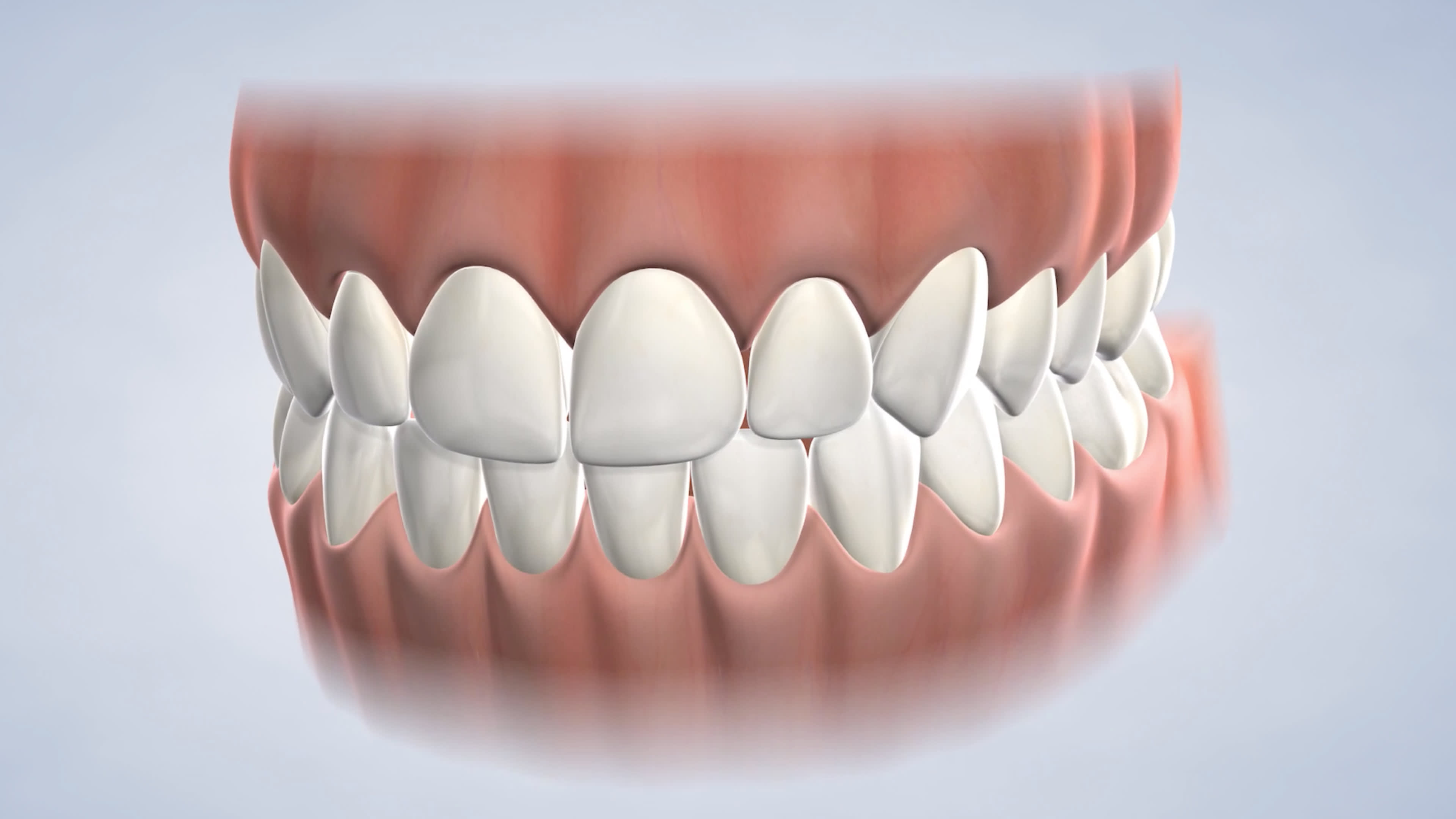 In-office procedure instructions